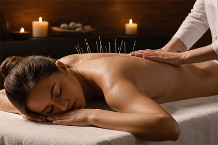 Acupuntura
